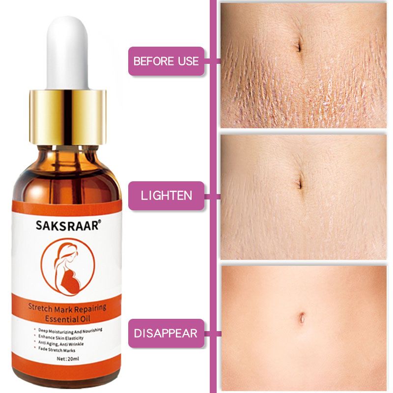 Stretch Mark Remover Essential Oil